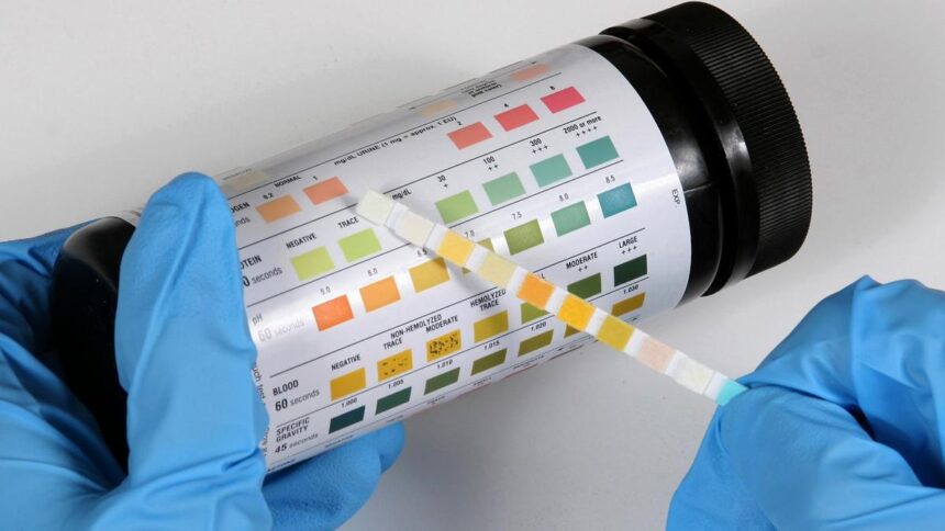 preventing-recurrent-urinary-tract-infections