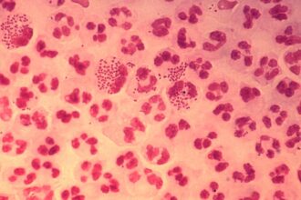 all-you-need-to-know-about:-gonorrhoea