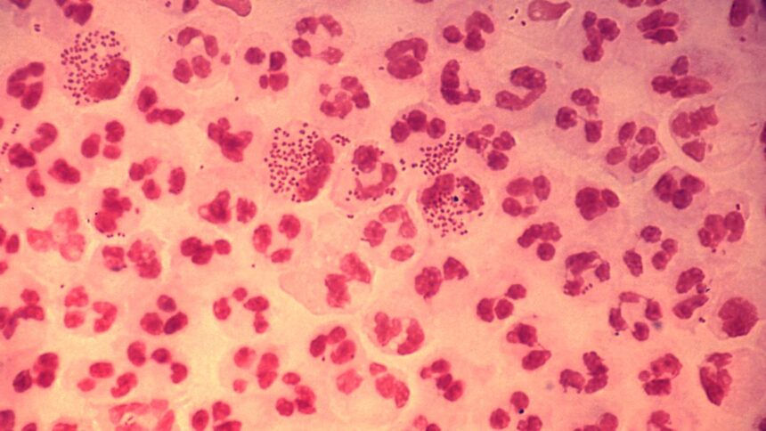 all-you-need-to-know-about:-gonorrhoea