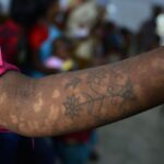 kala-azar-in-india:-treading-the-last-mile-towards-elimination