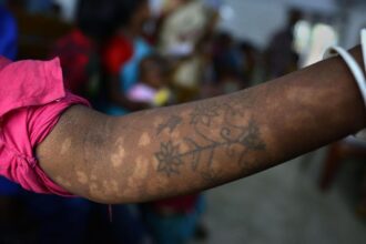 kala-azar-in-india:-treading-the-last-mile-towards-elimination