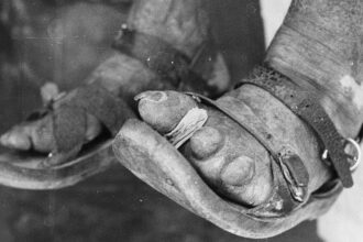 the-story-of-dapsone:-from-dye-to-drug