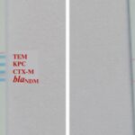 indian-scientists-make-affordable-dipstick-test-to-track-amr-in-sewage