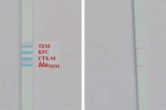 indian-scientists-make-affordable-dipstick-test-to-track-amr-in-sewage