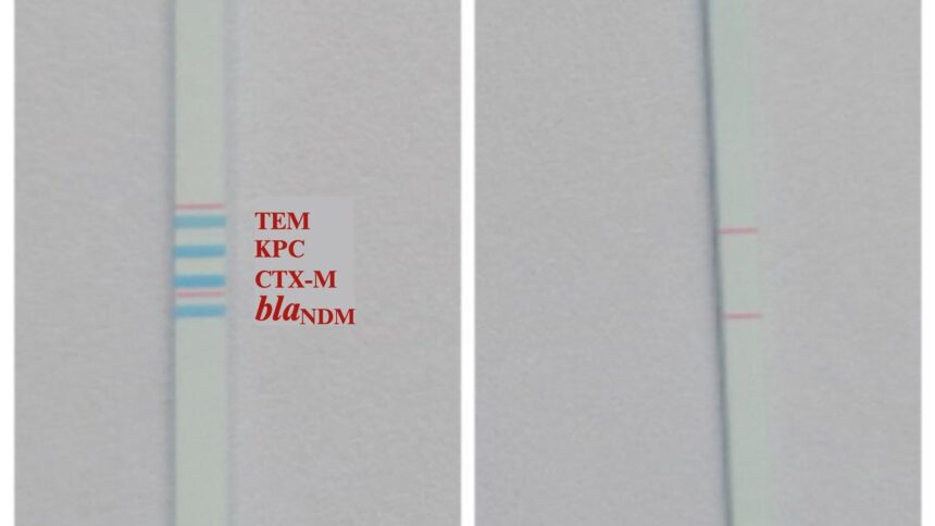 indian-scientists-make-affordable-dipstick-test-to-track-amr-in-sewage