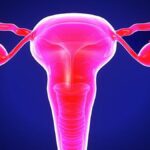 what-women-should-know-about-pelvic-inflammatory-disease