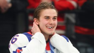 did-jack-hughes-lose-a-tooth-at-the-olympics?-how-did-he-lose-his-front-teeth?