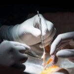 aiims-delhi-surgeons-remove-a-21.8-kg-uterine-sarcoma-tumor-in-a-high-risk-operation