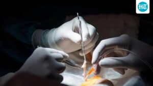 aiims-delhi-surgeons-remove-a-21.8-kg-uterine-sarcoma-tumor-in-a-high-risk-operation