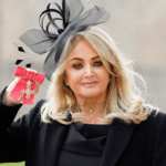 “total-eclipse-of-the-heart”-singer-bonnie-tyler-has-been-hospitalized-in-portugal-after-having-emergency-surgery