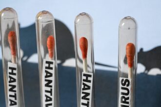 is-hantavirus-present-in-the-united-states?-updated-amidst-the-cruise-ship-chaos-of-2026