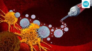 roche-launches-subcutaneous-lung-cancer-immunotherapy,-reducing-delivery-time-to-7-minutes