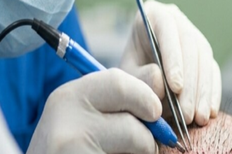 from-lahore-to-kashmir-to-a-hair-transplant-clinic:-how-a-terrorist-who-aimed-to-fight-baldness-converted-instead