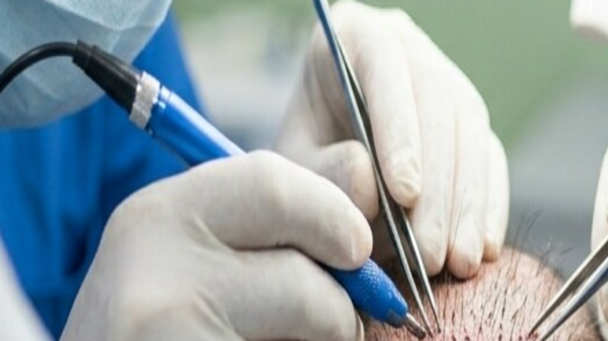 from-lahore-to-kashmir-to-a-hair-transplant-clinic:-how-a-terrorist-who-aimed-to-fight-baldness-converted-instead