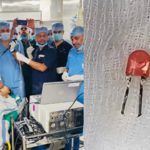 the-led-in-the-lung-was-removed-and-a-9-month-old-baby-was-saved-by-indian-army-doctors