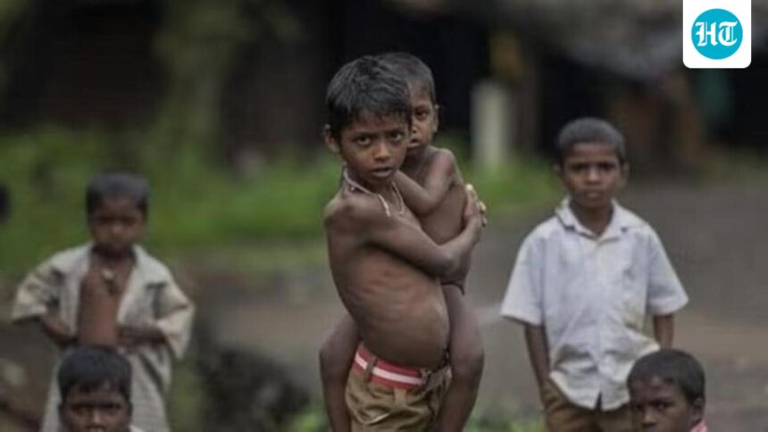 nfhs-6-madhya-pradesh-has-the-highest-rates-of-child-malnutrition-in-india | GIBN nfhs-6:-madhya-pradesh-has-the-highest-rates-of-child-malnutrition-in-india
