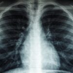 more-than-6,100-new-tb-cases-in-maharashtra-in-35-days;-11,091-villages-were-classified-as-high-risk
