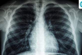 more-than-6,100-new-tb-cases-in-maharashtra-in-35-days;-11,091-villages-were-classified-as-high-risk