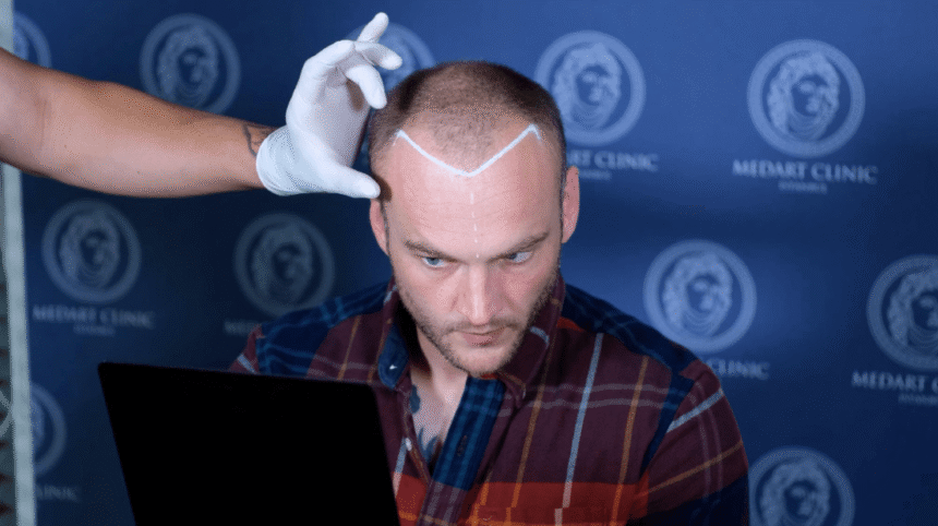 top-5-clinics-under-the-supervision-of-doctors-top-5-clinics-for-bulk-hair-transplantation-in-turkiye-for-complex-cases-in-2026 | GIBN top-5-clinics-under-the-supervision-of-doctors-top-5-clinics-for-bulk-hair-transplantation-in-turkiye-for-complex-cases-in-2026