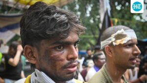 doctors-write-to-president-murmu-regarding-wangchuk’s-hospitalization,-actions-against-akp-protesters-in-jantar-mantar