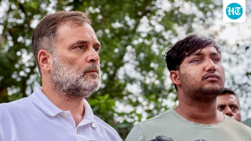 rahul-gandhi-shows-student’s-wounds-on-camera,-claims-pellet-guns-were-used-during-jantar-mantar-protest