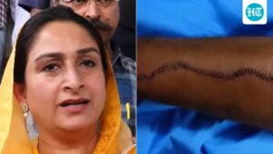 sad’s-harsimrat-shows-weapon-used-in-nanded-attack-on-sukhbir-singh-badal,-stitches-on-his-arm