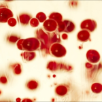 over-73.1-million-screened-for-sickle-cell-disease-in-3-years:-tribal-ministry