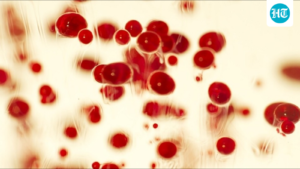 over-73.1-million-screened-for-sickle-cell-disease-in-3-years:-tribal-ministry