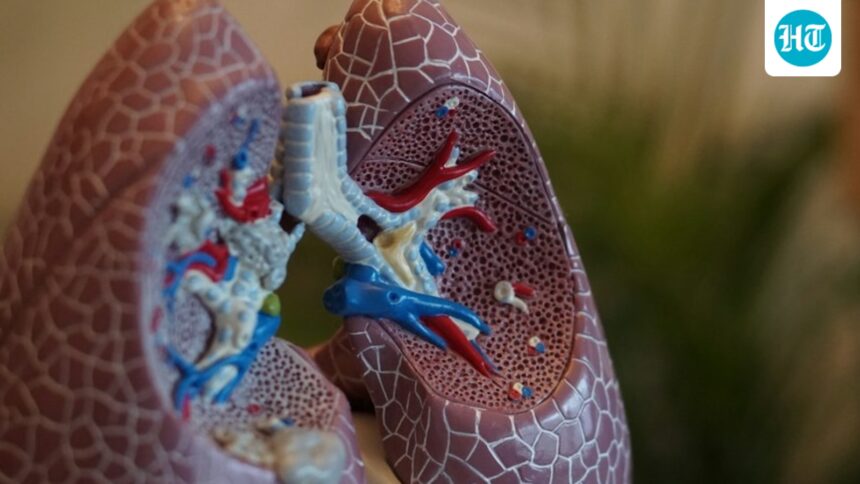 no-immediate-risk-to-india,-says-kerala-medical-body-expert-amid-pneumonic-plague-scare-in-russia